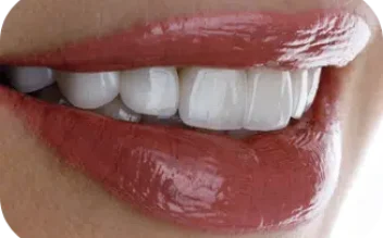 Aprimoramento Estético - Odontonin Clínica Odontológica em Brusque