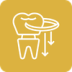 Implante Dentário em Brusque – Tecnologia Alemã e Resultado Natural