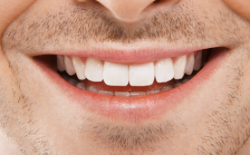 Proteção Contra Novas Cáries - Odontonin Clínica Odontológica em Brusque