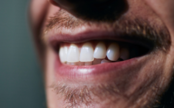 Sorriso Mais Iluminado - Odontonin Clínica Odontológica em Brusque